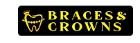 Braces and Crowns
